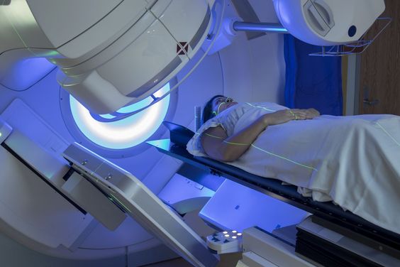 Understanding Radiation Therapy: What to Expect